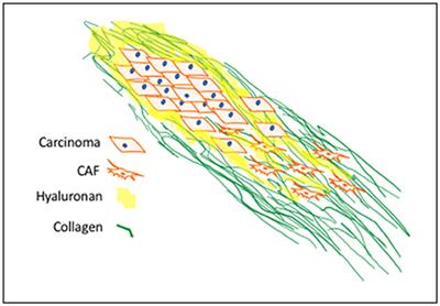 Hyaluronan, Cancer-Associated Fibroblasts and the Tumor Microenvironment in Malignant Progression